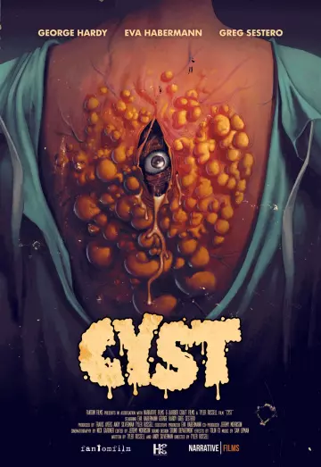 Cyst - FRENCH WEB-DL 720p